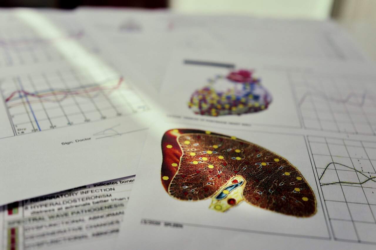 NLS health screening results with liver analysis chart