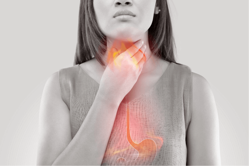Acid Reflux Treatment